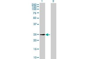 Western Blot analysis of METTL7A expression in transfected 293T cell line by METTL7A MaxPab polyclonal antibody. (METTL7A anticorps  (AA 1-244))