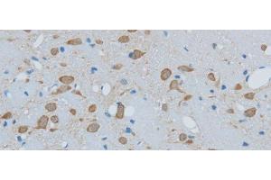 Immunohistochemistry of paraffin-embedded Mouse brain using TIMP4 Polyclonal Antibody at dilution of 1:50 (TIMP4 anticorps)