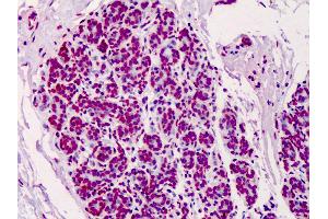 Anti-Poly ADP-Ribose antibody IHC of human breast. (Poly-ADP-Ribose anticorps)