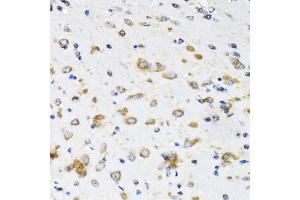 Immunohistochemistry of paraffin-embedded mouse brain using COPB2 antibody. (COPB2 anticorps)