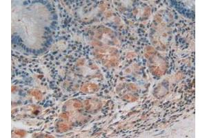 Detection of C3 in Human Stomach Tissue using Polyclonal Antibody to Complement Component 3 (C3)