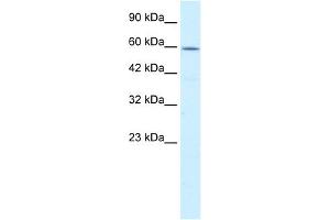 WB Suggested Anti-CCT4 Antibody Titration:  0. (CCT4 anticorps  (C-Term))