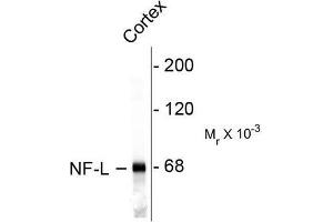 Image no. 1 for anti-Neurofilament, Light Polypeptide (NEFL) antibody (ABIN372673) (NEFL anticorps)