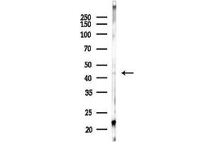 anti-Ribosomal Modification Protein RimK-Like Family Member A (RIMKLA) (Internal Region) antibody