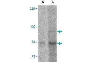 Western blot analysis of KDM3A in mouse liver tissue lysate with KDM3A polyclonal antibody  at (A) 1 and (B) 2 ug/mL . (KDM3A anticorps  (N-Term))