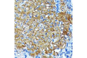 Immunohistochemistry of paraffin-embedded rat ovary using Leptin Receptor Rabbit mAb (ABIN7268210) at dilution of 1:100 (40x lens). (Leptin Receptor anticorps)
