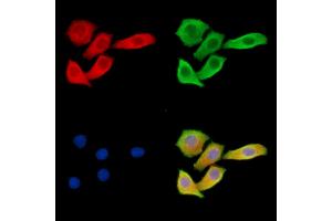 ABIN6263093 and ABIN6279535 staining Hela cells by IF/ICC. (MAP1A anticorps  (Internal Region))