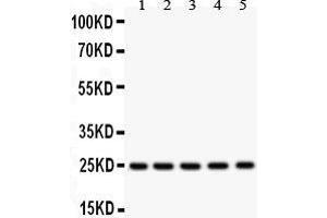 Anti-SOD2 Picoband antibody, Western blotting All lanes: Anti SOD2  at 0. (SOD2 anticorps  (C-Term))