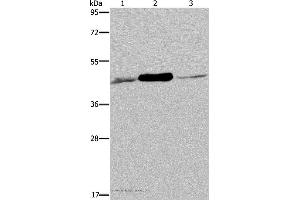 Western blot analysis of 293T and Jurkat cell, human fetal muscle tissue, using IDH2 Polyclonal Antibody at dilution of 1:600 (IDH2 anticorps)