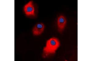 Immunofluorescent analysis of STEAP3 staining in HepG2 cells. (STEAP3 anticorps  (C-Term))