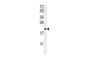 PTP4A2 Antibody (Center) (ABIN390820 and ABIN2841052) western blot analysis in NCI- cell line lysates (35 μg/lane).