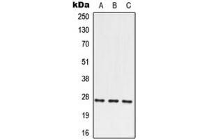 Western blot analysis of PRRX2 expression in HEK293T (A), SP2/0 (B), PC12 (C) whole cell lysates. (PRRX2 anticorps  (N-Term))