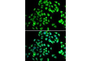 Immunofluorescence analysis of MCF-7 cells using NCBP2 antibody.