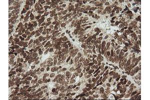 anti-Zinc Finger and SCAN Domain Containing 18 (ZSCAN18) antibody