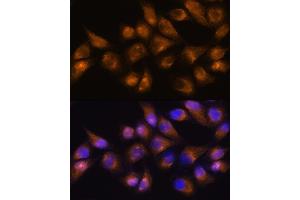 Immunofluorescence analysis of HeLa cells using CD13/CD13/ANPEP Rabbit pAb (ABIN6131185, ABIN6136911, ABIN6136912 and ABIN6221309) at dilution of 1:100.
