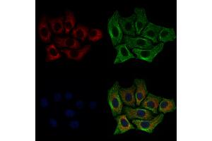 ABIN6257484 and ABIN6274780 staining HepG2 cells by IF/ICC. (RPL35 anticorps  (C-Term))