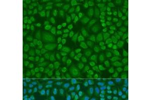 Immunofluorescence analysis of U2OS cells using DROSHA Polyclonal Antibody at dilution of 1:100. (DROSHA anticorps)