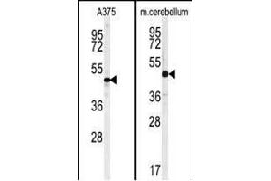 (LEFT)Western blot analysis of C10orf46 Antibody (C-term) (ABIN651189 and ABIN2840118) in  cell line lysates (35 μg/lane). (CACUL1 anticorps  (C-Term))