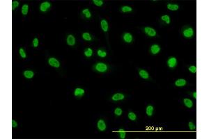 Immunofluorescence of monoclonal antibody to NFIC on HeLa cell. (NFIC anticorps  (AA 314-423))