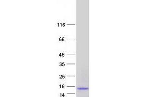 Validation with Western Blot