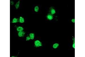 Anti-PDE4B mouse monoclonal antibody (ABIN2454961) immunofluorescent staining of COS7 cells transiently transfected by pCMV6-ENTRY PDE4B (RC211956). (PDE4B anticorps)