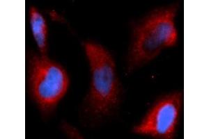 Immunofluorescence (IF) image for anti-Transforming Growth Factor, beta 1 (TGFB1) (AA 279-390) antibody (APC) (ABIN5566209) (TGFB1 anticorps  (AA 279-390) (APC))