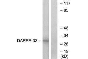 Western blot analysis of extracts from COS-7 cells, treated with forskolin (40nM, 30mins), using DARPP-32 (Ab-34) antibody. (DARPP32 anticorps  (Thr34))