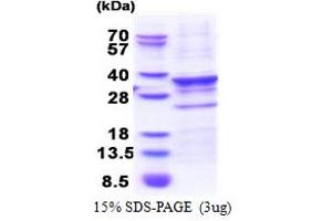 SDS-PAGE (SDS) image for Centromere Protein Q (CENPQ) (AA 1-268) protein (His tag) (ABIN5853442)
