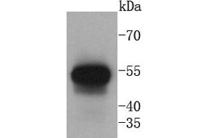 Human lung lysates probed with Cytokeratin 13 (5A3) Monoclonal Antibody at 1:1000 overnight at 4˚C.