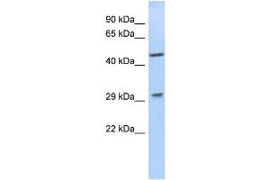 WB Suggested Anti-LIX1 Antibody Titration: 0. (LIX1 anticorps  (N-Term))