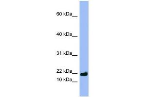 SPRR3 antibody used at 1 ug/ml to detect target protein. (SPRR3 anticorps  (Middle Region))