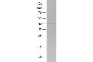 Western Blotting (WB) image for Phosphoinositide 3 Kinase, p85 alpha (PI3K p85a) (AA 44-201) protein (His-IF2DI Tag) (ABIN7124425)