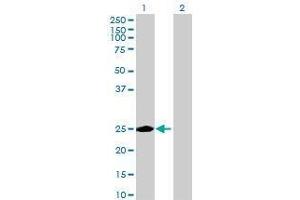 Lane 1: KIAA0892 transfected lysate ( 24. (KIAA0892 293T Cell Transient Overexpression Lysate(Denatured))
