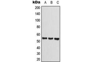Western blot analysis of CLEC14A expression in HEK293T (A), Raw264. (CLEC14A anticorps  (Center))