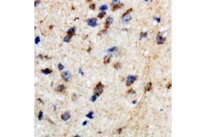 Immunohistochemical analysis of BTBD6 staining in human brain formalin fixed paraffin embedded tissue section. (BTBD6 anticorps)