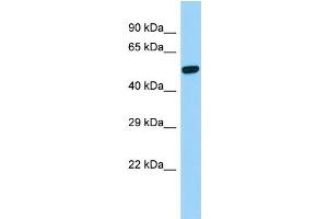 Host:  Rabbit  Target Name:  Psen2  Sample Type:  Rat Stomach lysates  Antibody Dilution:  1. (Presenilin 2 anticorps  (C-Term))