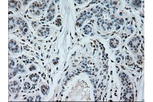 Immunohistochemical staining of paraffin-embedded breast tissue using anti-NEUROG1 mouse monoclonal antibody. (Neurogenin 1 anticorps)