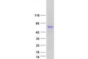 Validation with Western Blot