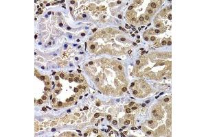 Immunohistochemistry of paraffin-embedded human kidney using DNAJB6 antibody.