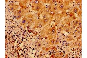 Immunohistochemistry of paraffin-embedded human liver tissue using ABIN7175121 at dilution of 1:100
