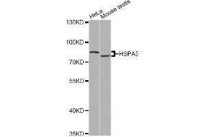 Western blot analysis of extracts of various cell lines, using HSPA5 antibody (ABIN5997938) at 1/500 dilution. (GRP78 anticorps)