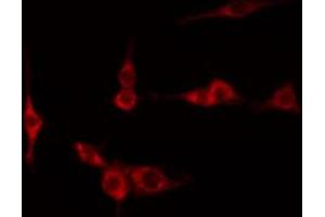 ABIN6267219 staining Hela by IF/ICC. (NFKBIE anticorps  (pSer161))