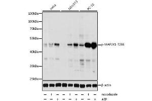 Western blot analysis of extracts of various cell lines, using Phospho-MAP2K1-T286 antibody. (MEK1 anticorps  (pThr286))