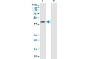 Western Blot analysis of TMOD1 expression in transfected 293T cell line by TMOD1 MaxPab polyclonal antibody. (Tropomodulin 1 anticorps  (AA 1-359))
