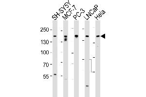 Western blot analysis of lysates from SH-SY5Y, MCF-7, PC-3, LNCaP, Hela, cell line (from left to right), using Tuberin (TSC2) Antibody (ABIN390324 and ABIN2840755). (Tuberin anticorps  (AA 1776-1805))