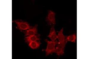 ABIN6278557 staining HepG2 by IF/ICC. (CCRL2 anticorps  (Internal Region))