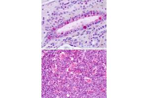 Immunohistochemical staining of formalin-fixed, paraffin-embedded human tonsil with LPHN3 polyclonal antibody . (LPHN3 anticorps  (C-Term))