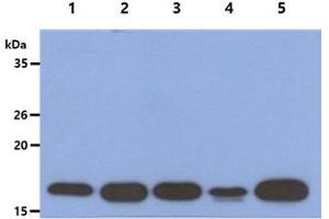 The Cell lysates (40ug) were resolved by SDS-PAGE, transferred to PVDF membrane and probed with anti-human ACP1 antibody (1:1000). (ACP1 anticorps)