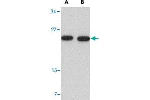 Western blot analysis of POFUT1 in human heart tissue lysate with POFUT1 polyclonal antibody  at (A) 0. (POFUT1 anticorps  (N-Term))