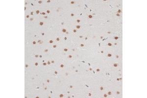 Immunohistochemistry of paraffin-embedded mouse brain using ZNF148 antibody (ABIN6130815, ABIN6150463, ABIN6150464 and ABIN6222770) at dilution of 1:100 (40x lens). (ZNF148 anticorps  (AA 690-794))